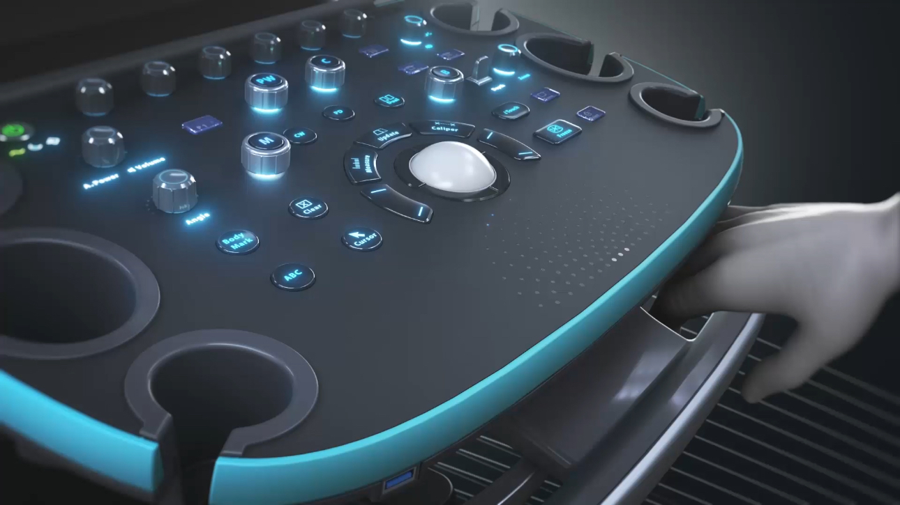 The Resona I9: A New Era of Diagnostic Ultrasound Systems The Resona I9: A New Era of Diagnostic Ultrasound Systems